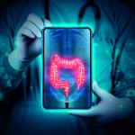 Bequest aids bowel cancer research